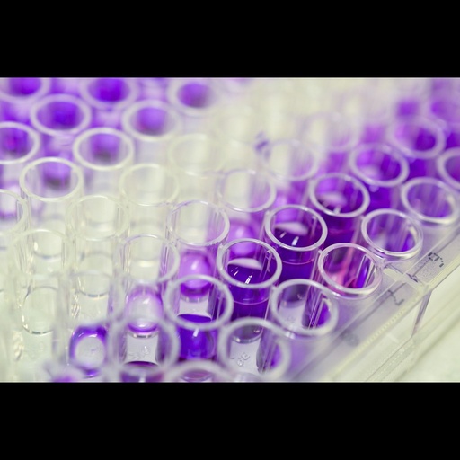 [0544-MBS457667-96] AP17 rtu elisa kit :: Human Apelin 17 (AP17) RTU ELISA Kit - 96-Strip-Wells